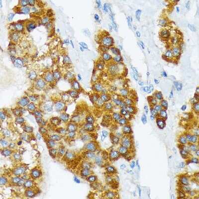 Immunohistochemistry-Paraffin: ATPase Na+/K+ beta 3 Antibody (0B7M7) [NBP3-15829]