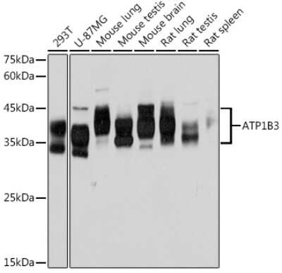 Western Blot: ATPase Na+/K+ beta 3 Antibody (0B7M7) [NBP3-15829]