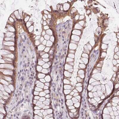 Immunohistochemistry-Paraffin: ATPase Na+/K+ beta 3 Antibody [NBP2-38595]