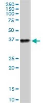 Western Blot: ATPase Na+/K+ beta 3 Antibody [H00000483-B01P]