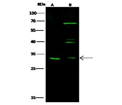 Western Blot: ATPase Na+/K+ beta 3 Antibody [NBP2-98896]