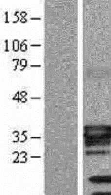 Western Blot: ATPase Na+/K+ beta 3 Overexpression Lysate [NBL1-07812]