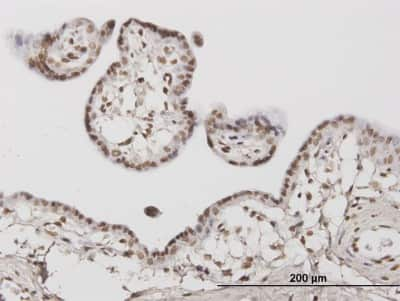 Immunohistochemistry-Paraffin: ATR Antibody (1E9) [H00000545-M03]