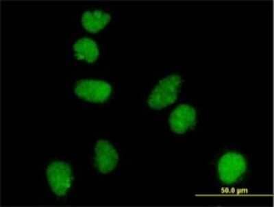 Immunocytochemistry/ Immunofluorescence: ATR Antibody (3F2) [H00000545-M01]