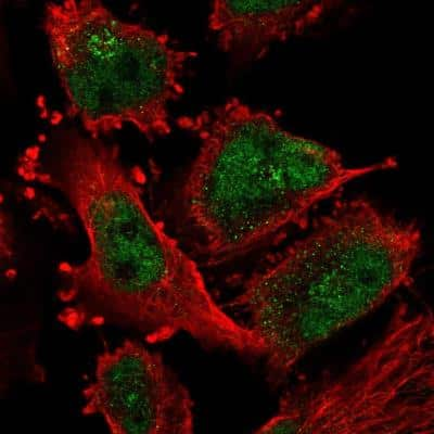 Immunocytochemistry/ Immunofluorescence: ATR Antibody [NBP2-76547]