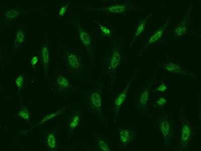 Immunocytochemistry/ Immunofluorescence: ATR Antibody [NBP2-98982]