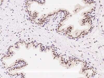 Immunohistochemistry-Paraffin: ATR Antibody [NBP2-98982]