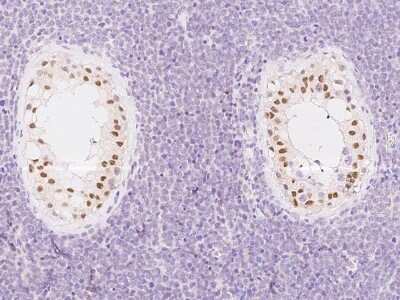 Immunohistochemistry-Paraffin: ATR Antibody [NBP2-98982]