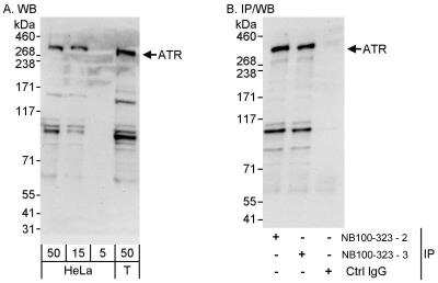 Western Blot: ATR Antibody [NB100-323]