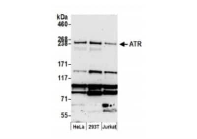 Western Blot: ATR Antibody [NB100-323]