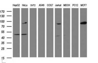 Western Blot: ATRIP Antibody (OTI1G6) [NBP2-46557]