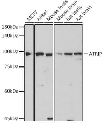 Western Blot: ATRIP Antibody (2C4B6) [NBP3-15738]