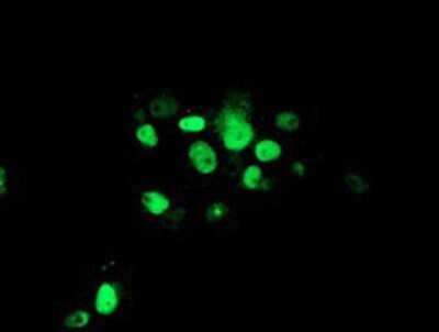 Immunocytochemistry/ Immunofluorescence: ATRIP Antibody (OTI5E7) [NBP2-02004]
