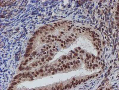 Immunohistochemistry-Paraffin: ATRIP Antibody (OTI5E7) [NBP2-02004]