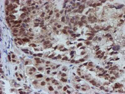 Immunohistochemistry-Paraffin: ATRIP Antibody (OTI5E7) [NBP2-02004]