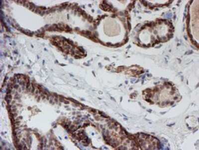 Immunohistochemistry-Paraffin: ATRIP Antibody (OTI5E7) [NBP2-02004]