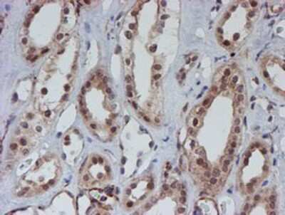 Immunohistochemistry-Paraffin: ATRIP Antibody (OTI5E7) [NBP2-02004]