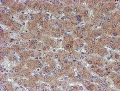 Immunohistochemistry-Paraffin: ATRIP Antibody (OTI5E7) [NBP2-02004]