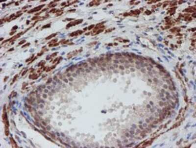 Immunohistochemistry-Paraffin: ATRIP Antibody (OTI5E7) [NBP2-02004]