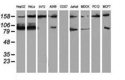 Western Blot: ATRIP Antibody (OTI5E7) [NBP2-02004]