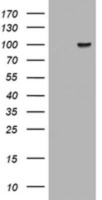 Western Blot: ATRIP Antibody (OTI1G6)Azide and BSA Free [NBP2-72270]