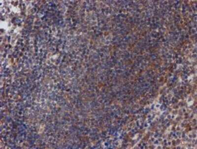 Immunohistochemistry: ATRIP Antibody (OTI5E7) - Azide and BSA Free [NBP2-72271]