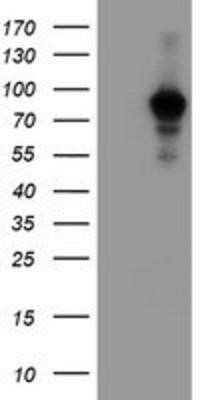 Western Blot: ATRIP Antibody (OTI5E7)Azide and BSA Free [NBP2-72271]