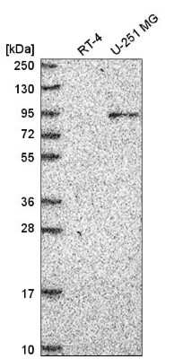 Western Blot: ATRIP Antibody [NBP2-55702]