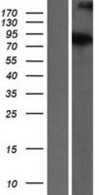 Western Blot: ATRIP Overexpression Lysate [NBL1-07853]