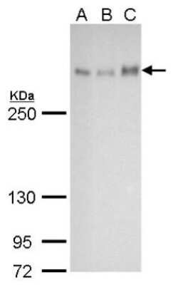 Western Blot: ATRX Antibody (4212) [NBP2-43599]