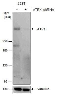 Western Blot: ATRX Antibody (4212) [NBP2-43599]