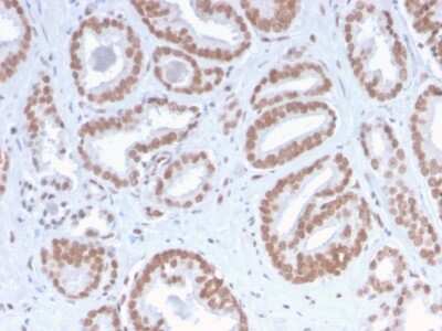 Immunohistochemistry-Paraffin: ATRX Antibody (ATRX/2900R) - Azide and BSA Free [NBP3-08693]