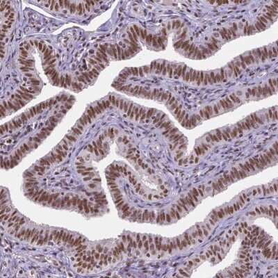 Immunohistochemistry-Paraffin: ATRX Antibody (CL0537) [NBP2-52938]