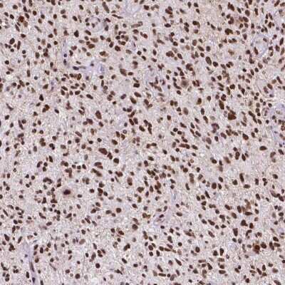 Immunohistochemistry-Paraffin: ATRX Antibody (CL0537) [NBP2-52938]