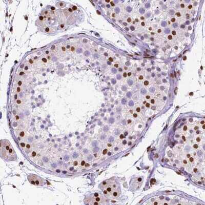 Immunohistochemistry-Paraffin: ATRX Antibody (CL0537) [NBP2-52938]