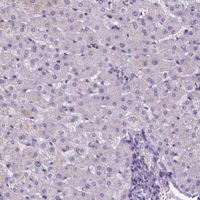 Immunohistochemistry-Paraffin: ATRX Antibody (CL0537) [NBP2-52938]
