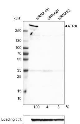 Western Blot: ATRX Antibody (CL0537) [NBP2-52938]