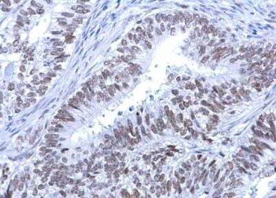Immunohistochemistry-Paraffin: ATRX Antibody [NBP1-32851]