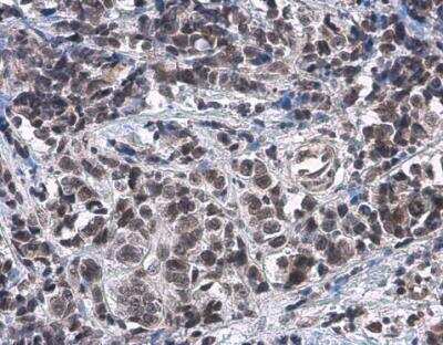Immunohistochemistry-Paraffin: ATRX Antibody [NBP1-32851]