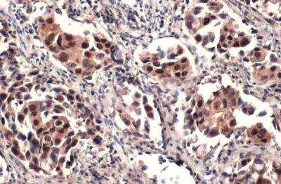 Immunohistochemistry-Paraffin: ATRX Antibody [NBP1-32851]