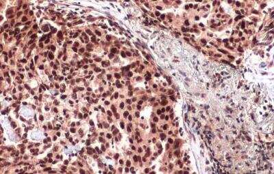 Immunohistochemistry-Paraffin: ATRX Antibody [NBP1-32851]
