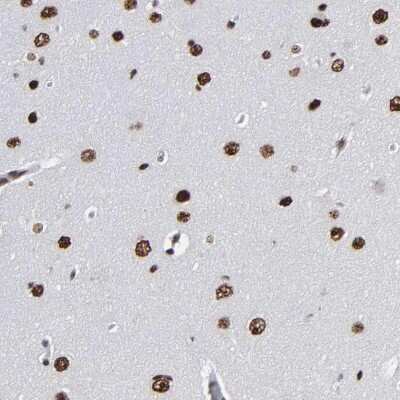 Immunohistochemistry-Paraffin: ATRX Antibody [NBP1-83077]