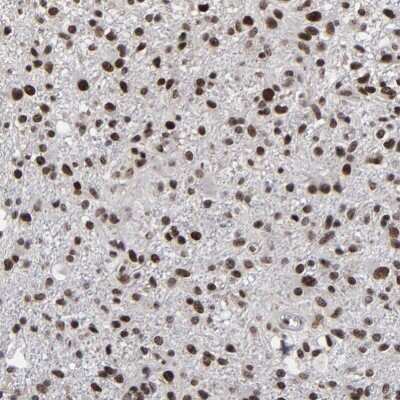 Immunohistochemistry-Paraffin: ATRX Antibody [NBP1-83077]