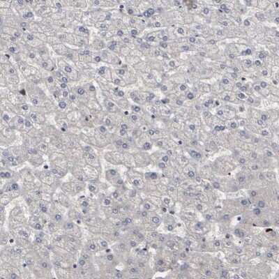 Immunohistochemistry-Paraffin: ATRX Antibody [NBP1-83077]