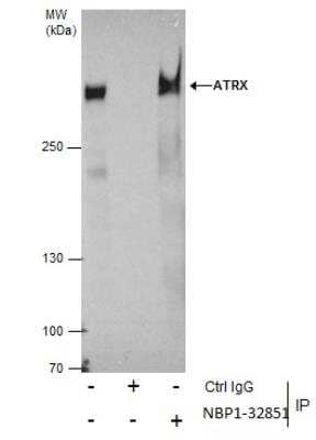Immunoprecipitation: ATRX Antibody [NBP1-32851]