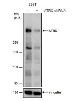 Western Blot: ATRX Antibody [NBP1-32851]