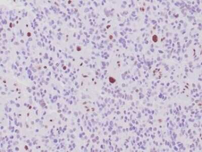 Immunohistochemistry-Paraffin: ATRX Antibody (rATRX/3446) - Azide and BSA Free [NBP3-08673]