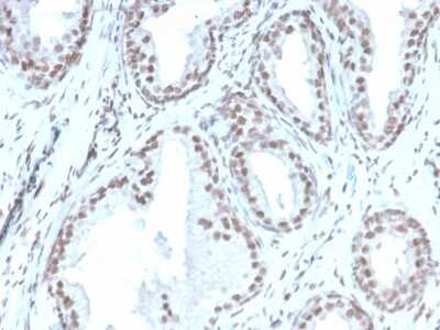 Immunohistochemistry-Paraffin: ATRX Antibody (rATRX/3446) [NBP3-07643]