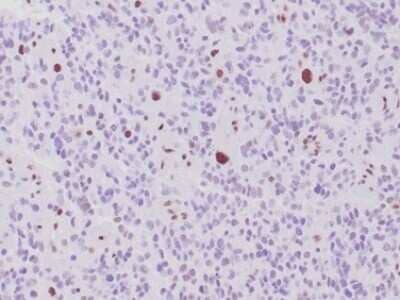 Immunohistochemistry-Paraffin: ATRX Antibody (rATRX/3446) [NBP3-07643]