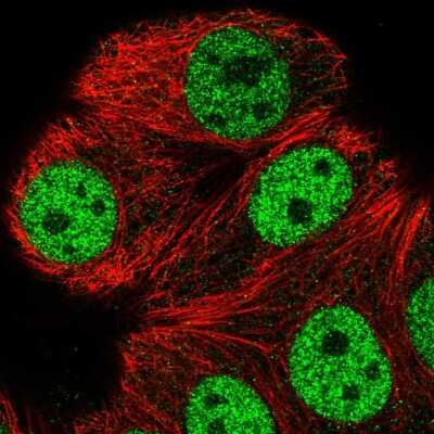 Immunocytochemistry/ Immunofluorescence: ATXN1L Antibody [NBP2-56746]